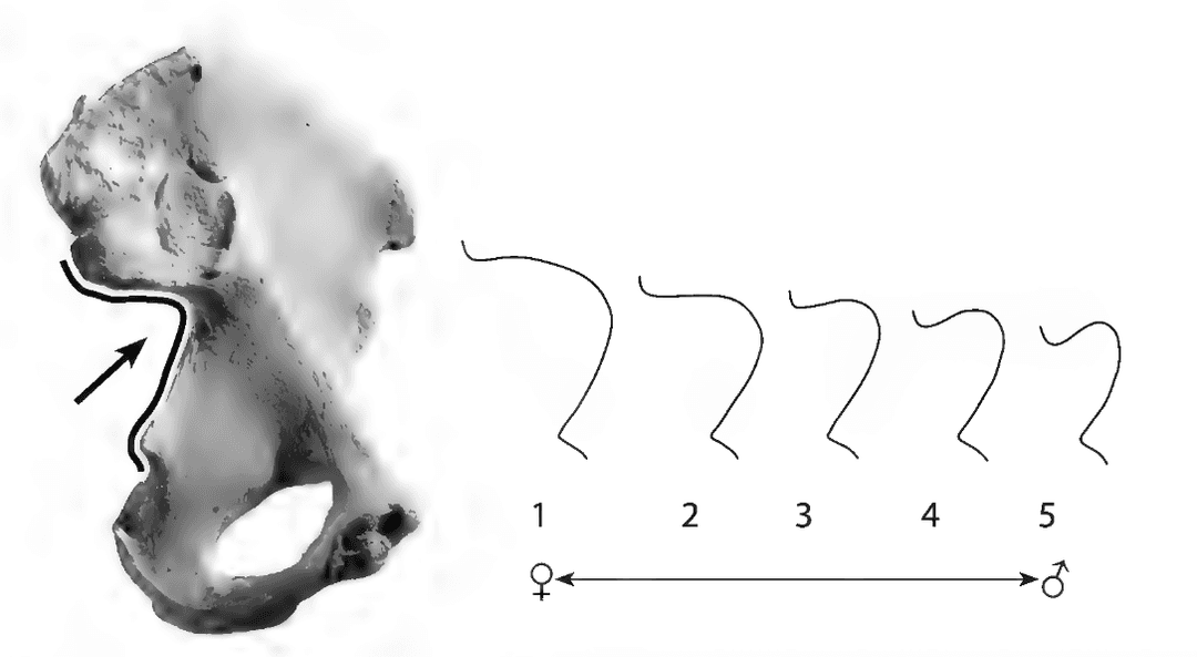 Sex estimation with the greater sciatic notch