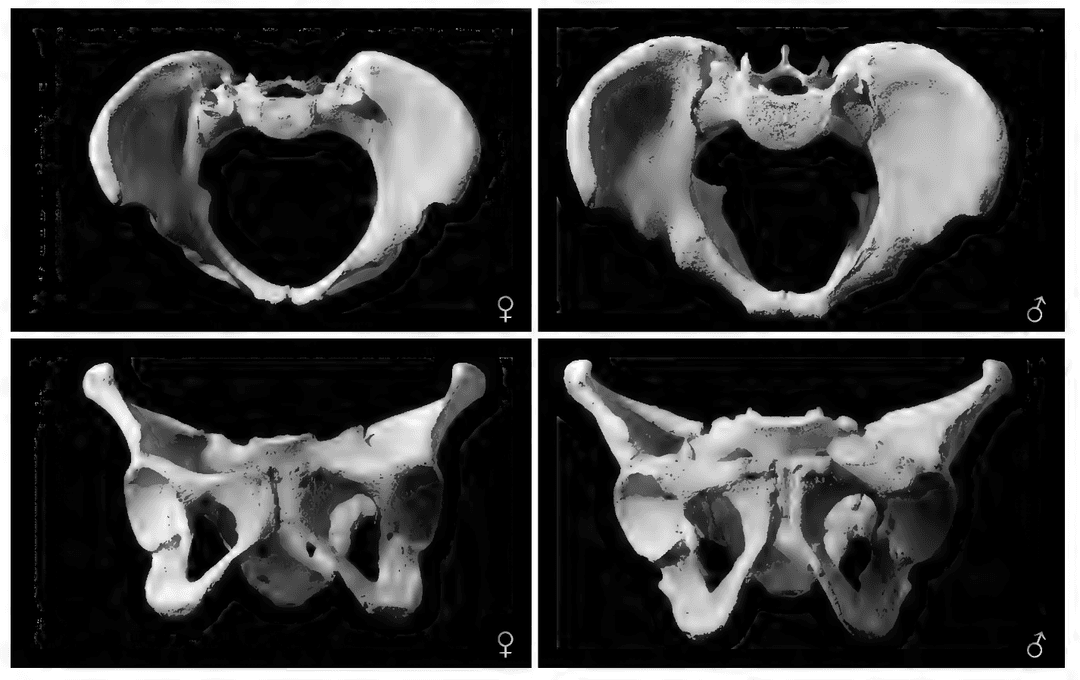 Sex estimation with the pelvis